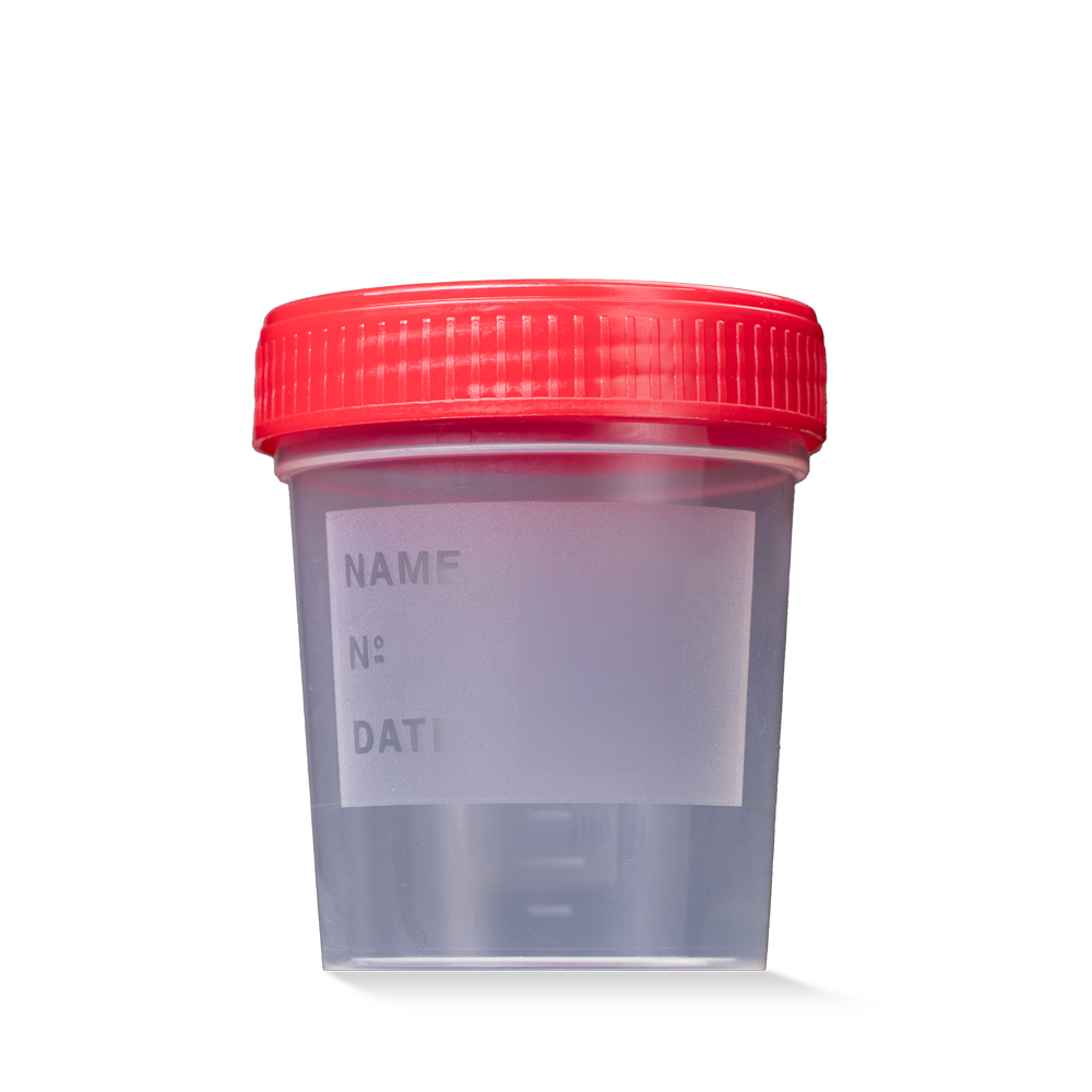L-09184-S Čaša urinska sterilna s crvenim poklopcem 200/1