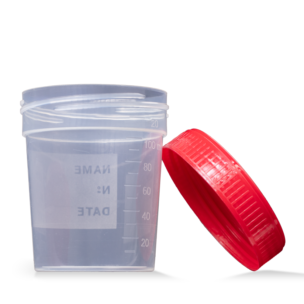 L-09184-S Čaša urinska sterilna s crvenim poklopcem 200/1