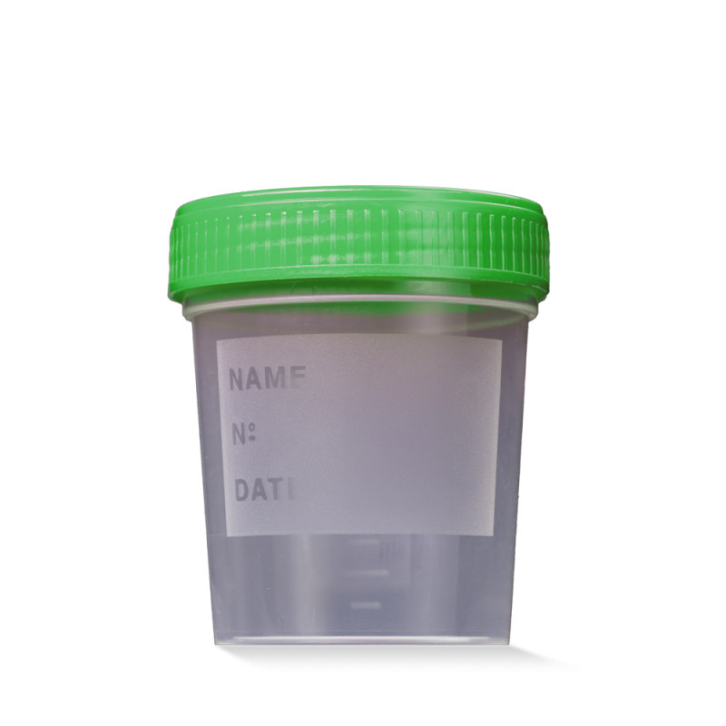 L-09184/100 MC Čaša za urin 100 mL zeleni poklopac 400 kom